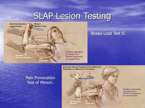 slap tear diagnosis tests|slap tear provocative test.